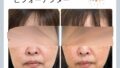 ビフォーアフター